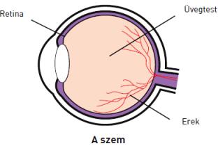 retinopátia cukorbetegség kezelésének)