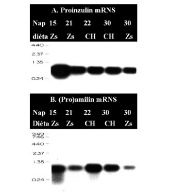 diabetes 2 típusú éhezés kezelés